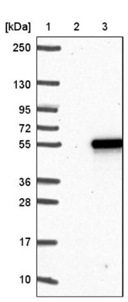 Western Blot: TWISTNB Antibody [NBP1-89449] - Lane 1: Marker [kDa] 250, 130, 95, 72, 55, 36, 28, 17, 10<br/>Lane 2: Negative control (vector only transfected HEK293T lysate)<br/>Lane 3: Over-expression lysate (Co-expressed with a C-terminal myc-DDK tag (~3.1 kDa) in mammalian HEK293T cells, LY424120)