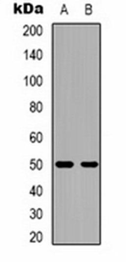 Western blot analysis of mouse brain (Lane 1), rat brain (Lane 2) whole cell lysates using CACNB3 antibody