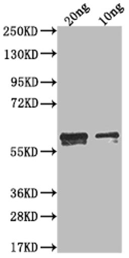 Western Blot. Positive WB detected in Recombinant protein. All lanes: N antibody at 1:2000. Secondary. Goat polyclonal to rabbit IgG at 1/50000 dilution. Predicted band size: 49.4 kDa. Observed band size: 60 kDa.