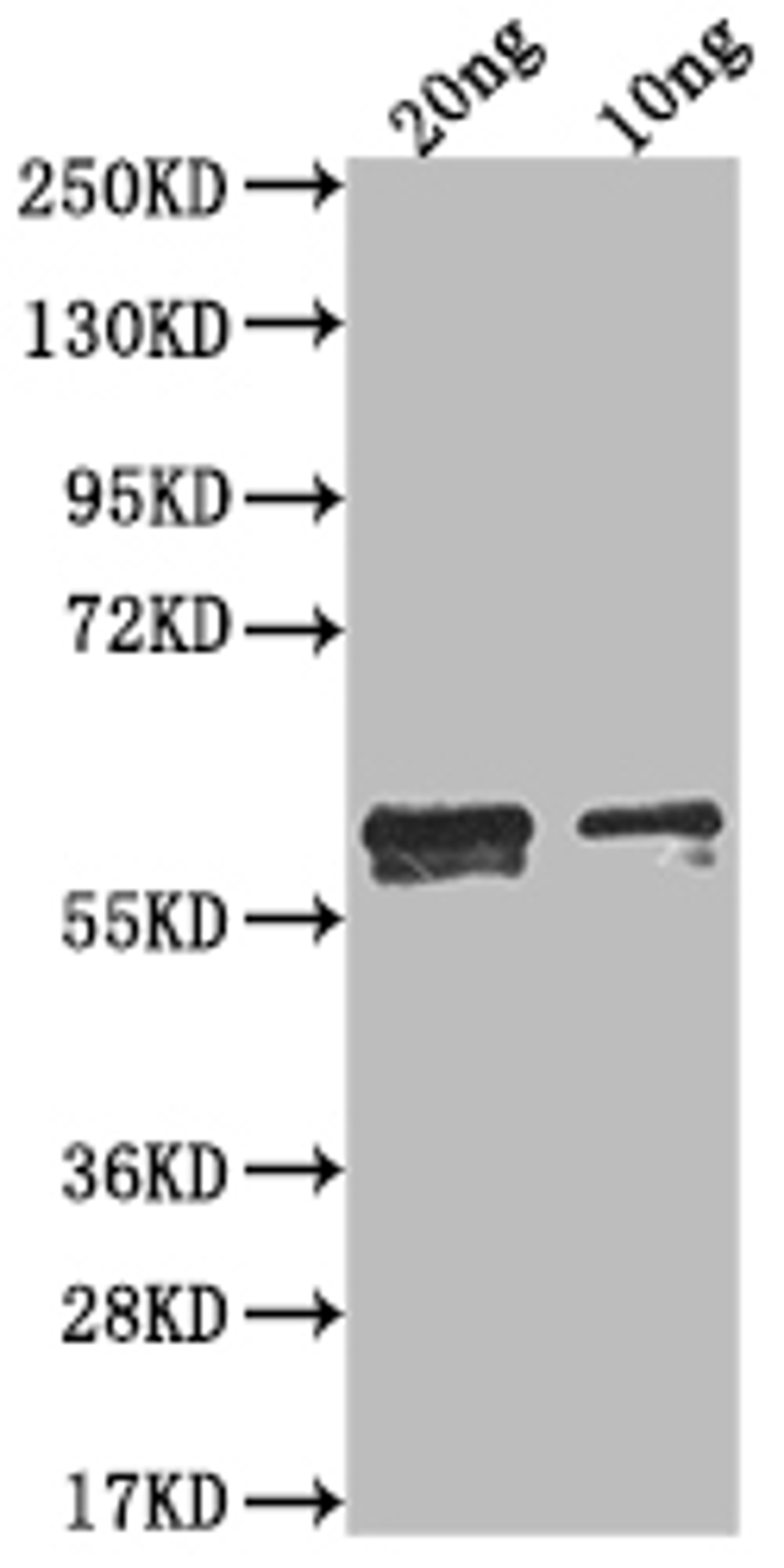 Western Blot. Positive WB detected in Recombinant protein. All lanes: N antibody at 1:2000. Secondary. Goat polyclonal to rabbit IgG at 1/50000 dilution. Predicted band size: 49.4 kDa. Observed band size: 60 kDa.