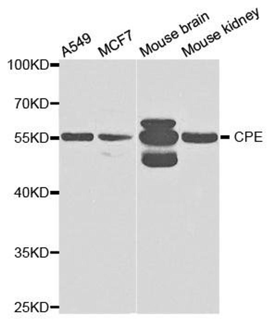 Western blot analysis of extracts of various cell lines using CPE antibody