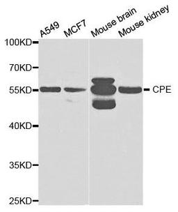 Western blot analysis of extracts of various cell lines using CPE antibody