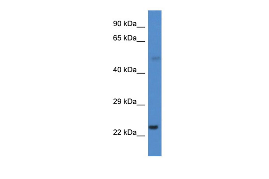 Antibody used in WB on Human Liver at 0.2-1 ug/ml.