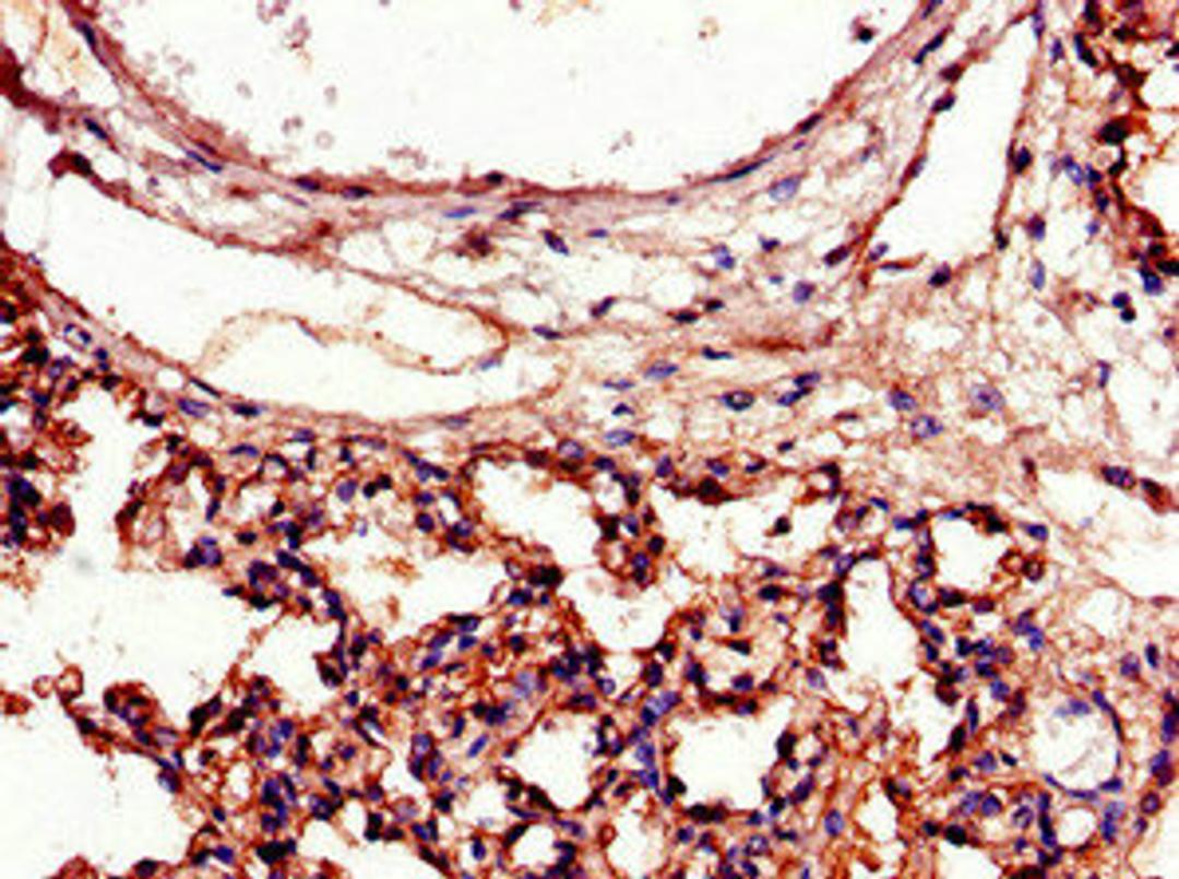 Immunohistochemistry of paraffin-embedded human lung tissue using CSB-PA07149A0Rb at dilution of 1:100