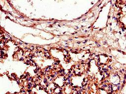 Immunohistochemistry of paraffin-embedded human lung tissue using CSB-PA07149A0Rb at dilution of 1:100