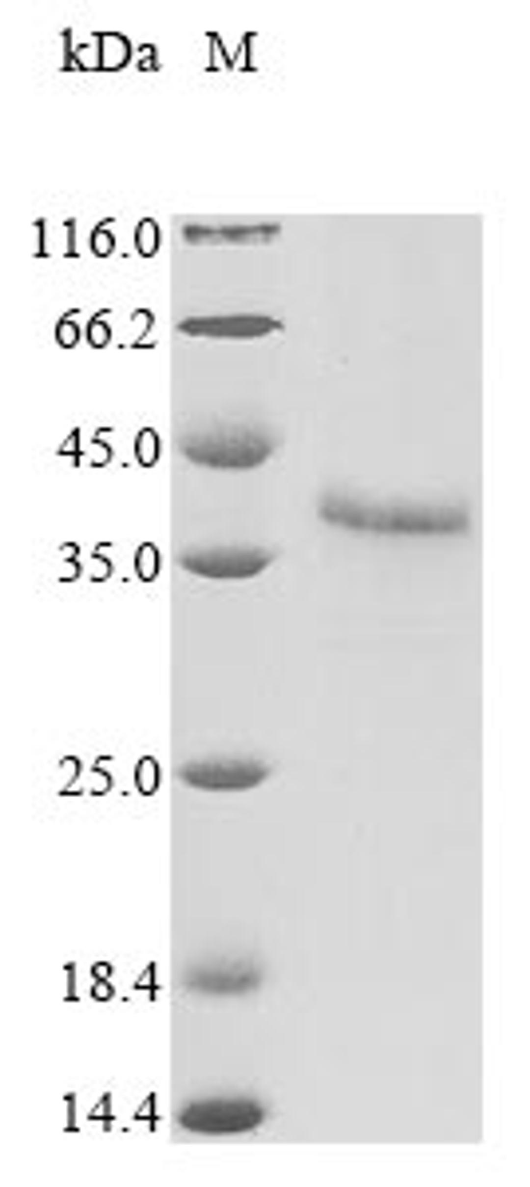 (Tris-Glycine gel) Discontinuous SDS-PAGE (reduced) with 5% enrichment gel and 15% separation gel.