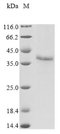 (Tris-Glycine gel) Discontinuous SDS-PAGE (reduced) with 5% enrichment gel and 15% separation gel.