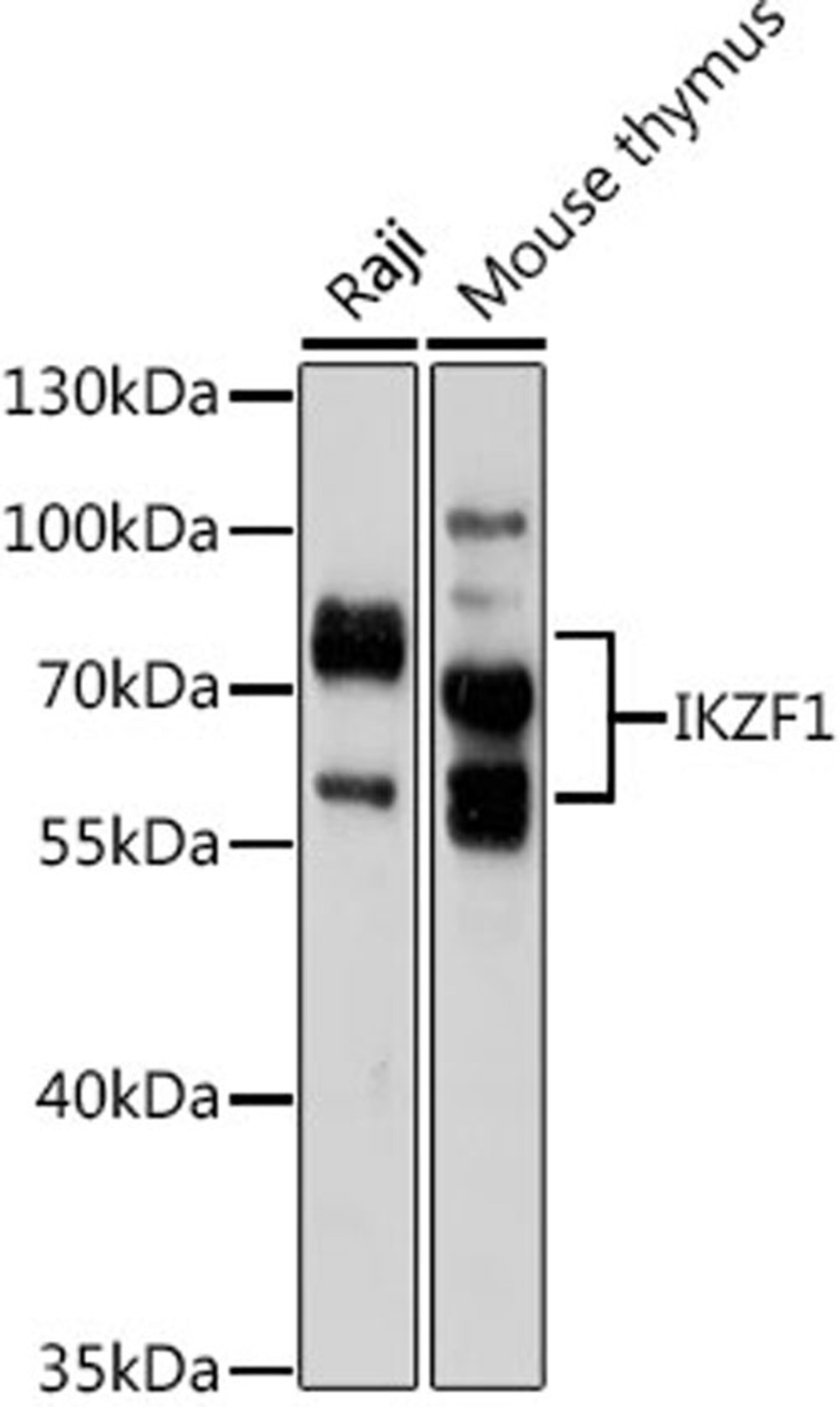 Western blot - IKZF1 antibody (A1850)