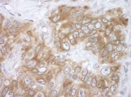 Detection of human VAPB by immunohistochemistry.