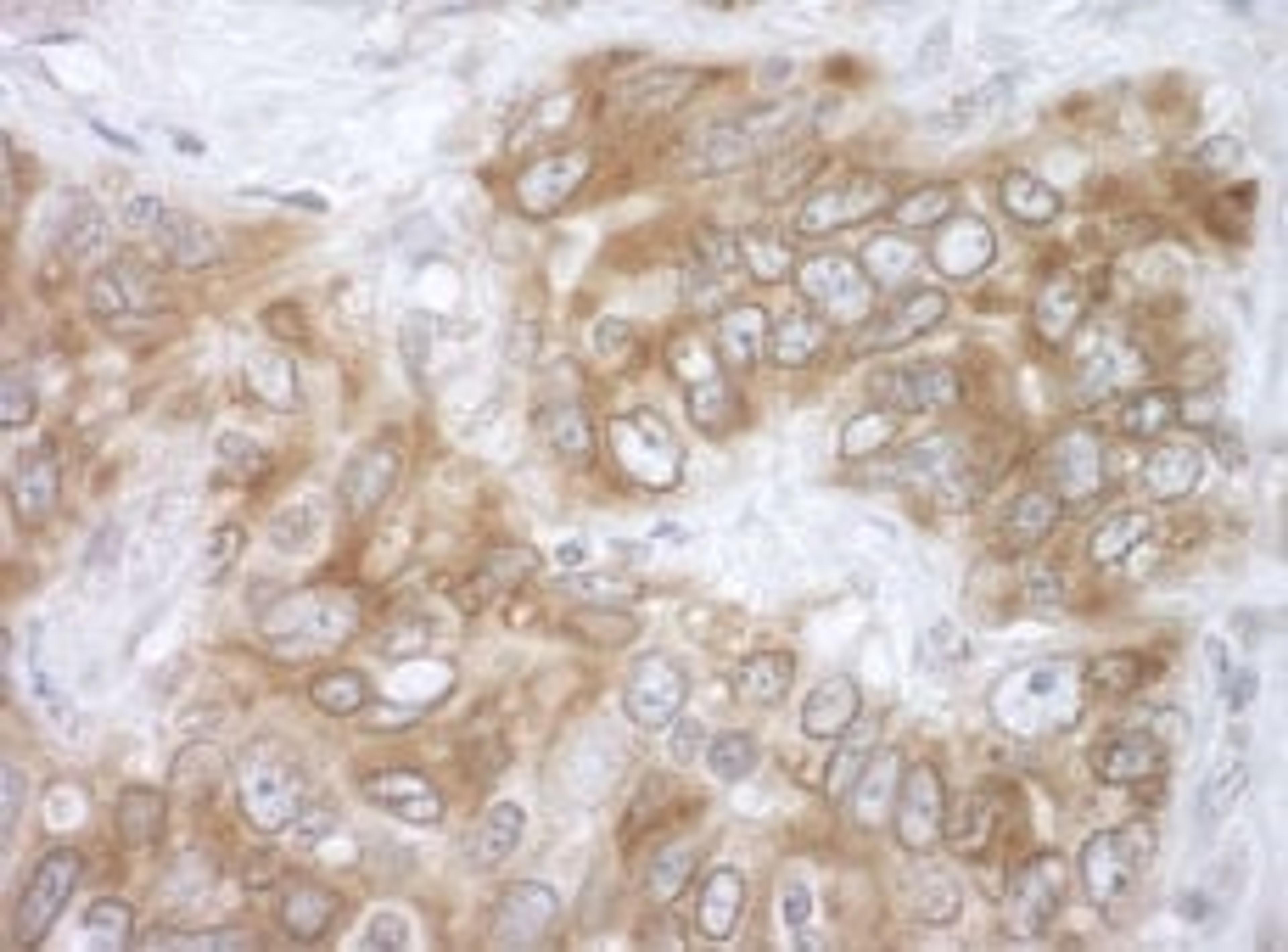 Detection of human VAPB by immunohistochemistry.