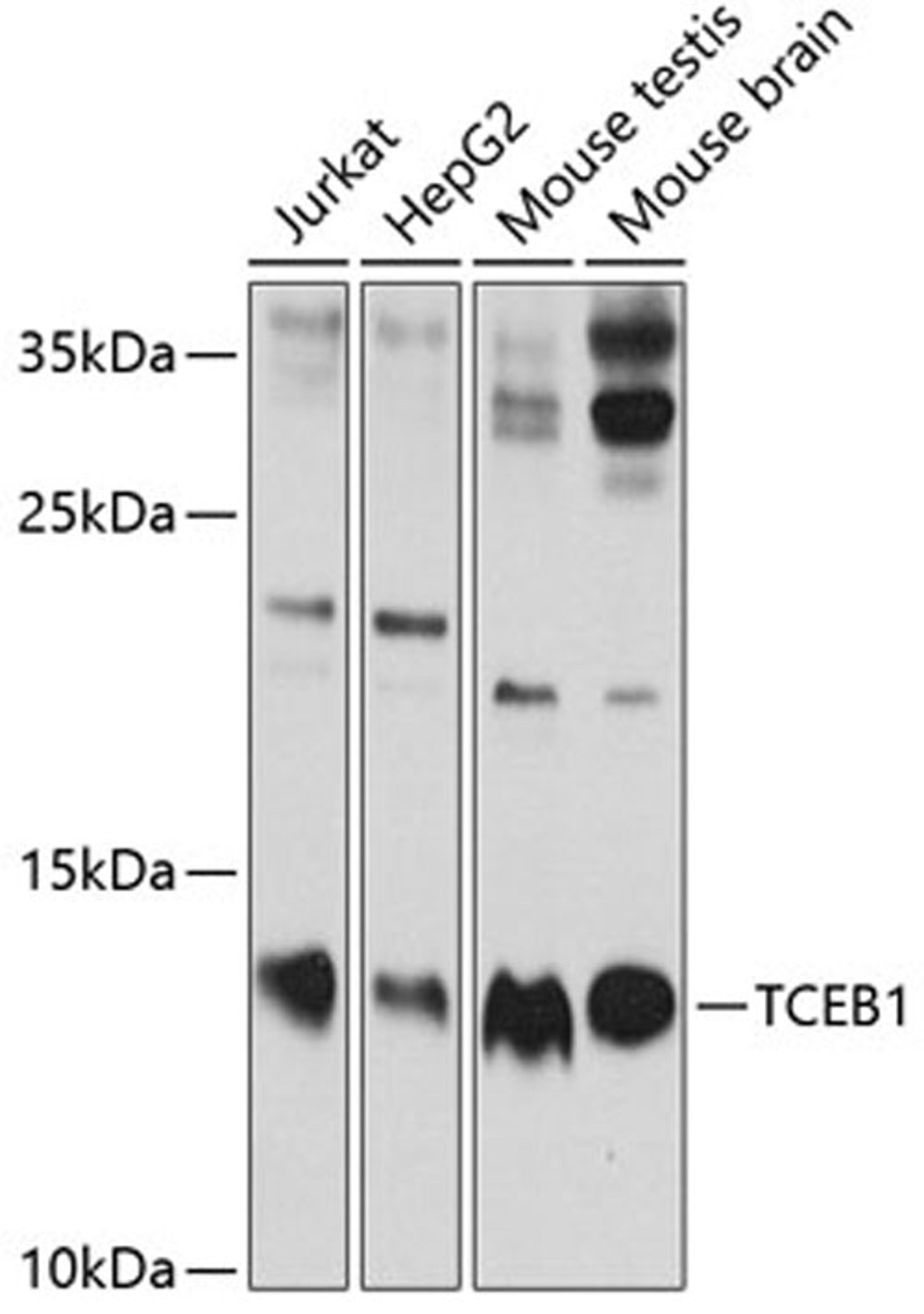 Western blot - TCEB1 antibody (A1989)