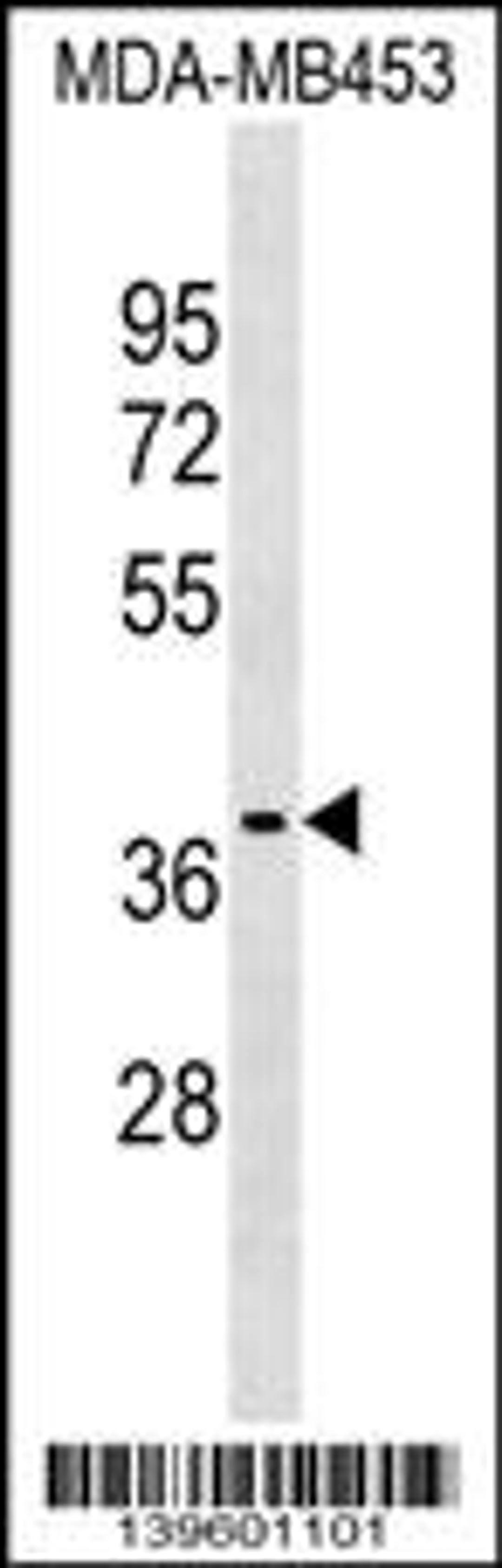 Western blot analysis in MDA-MB453 cell line lysates (35ug/lane).