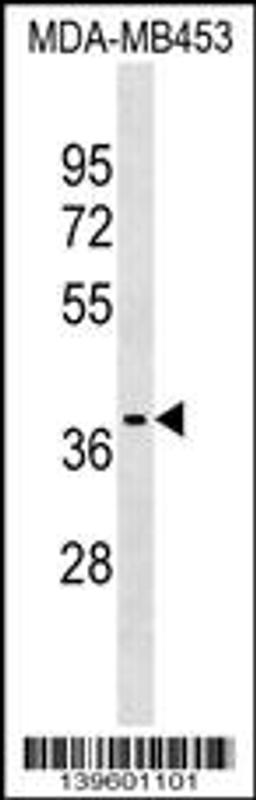 Western blot analysis in MDA-MB453 cell line lysates (35ug/lane).