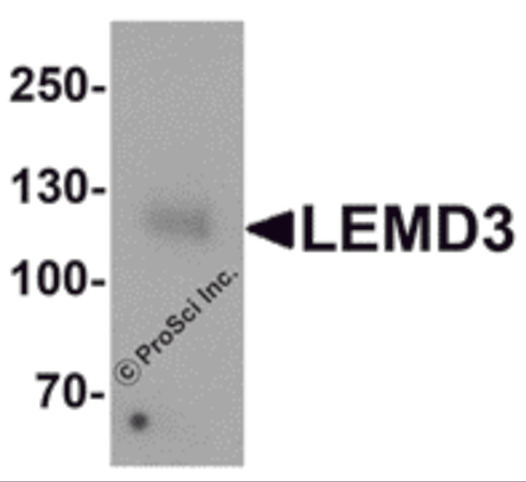 Western blot analysis of LEMD3 in human colon tissue lysate with LEMD3 antibody at 1 μg/mL.