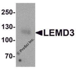 Western blot analysis of LEMD3 in human colon tissue lysate with LEMD3 antibody at 1 μg/mL.