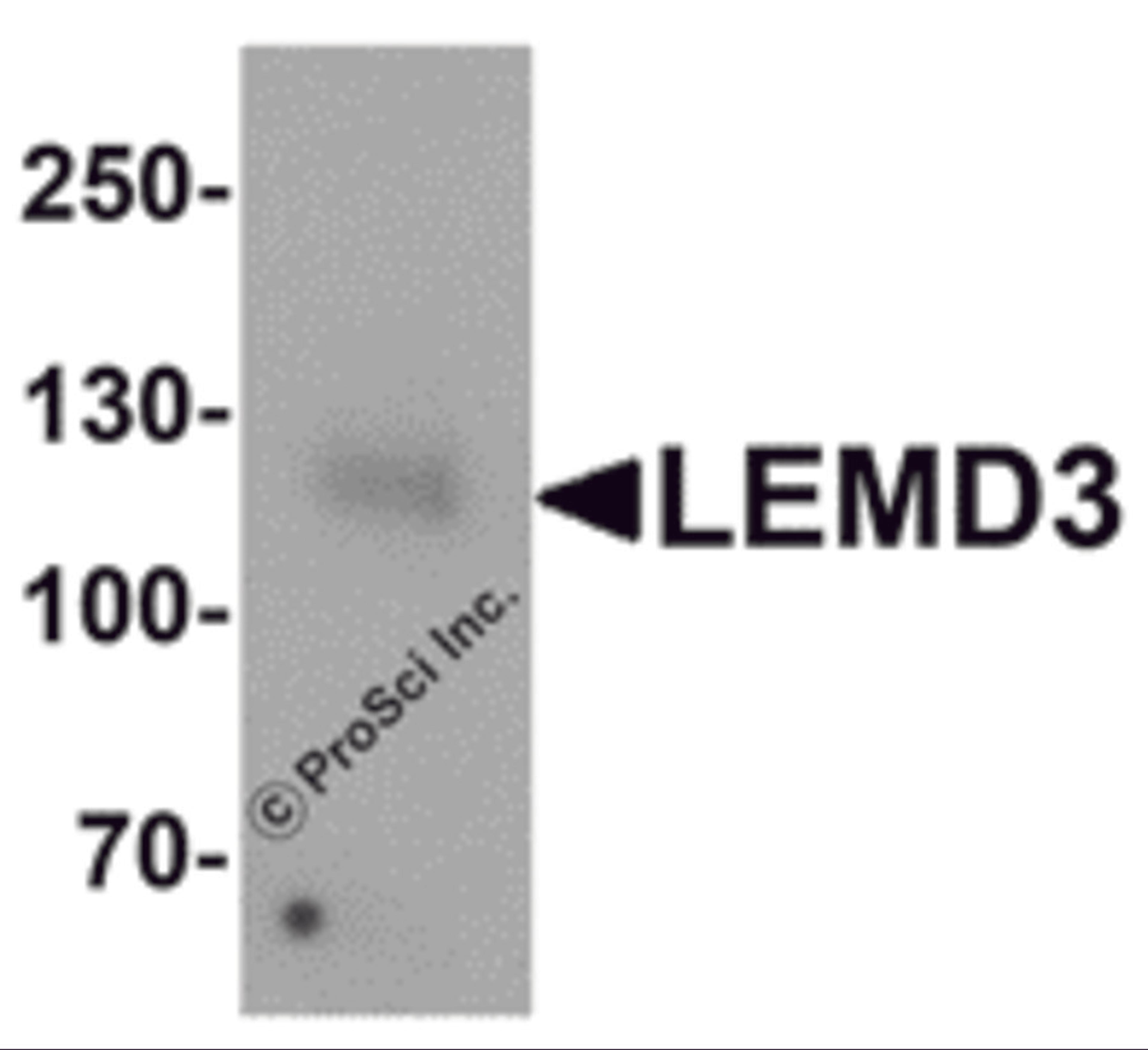 Western blot analysis of LEMD3 in human colon tissue lysate with LEMD3 antibody at 1 μg/mL.