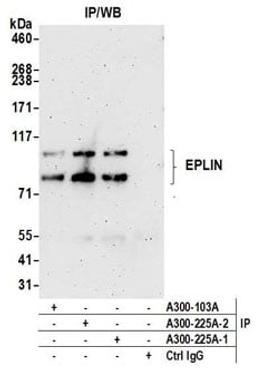 Detection of human EPLIN by western blot of immunoprecipitates.