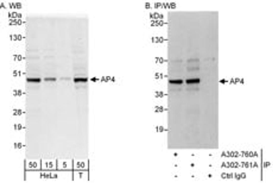 Detection of human AP4 by western blot and immunoprecipitation.