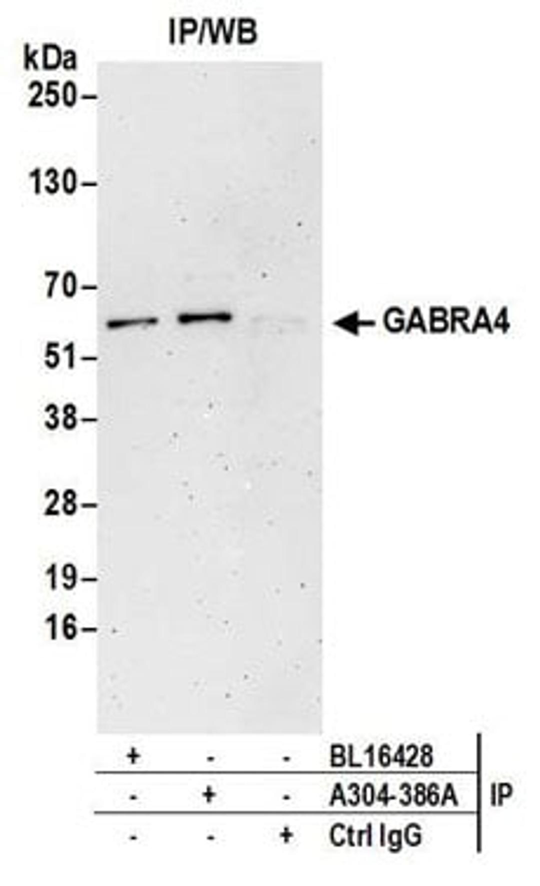 Detection of human GABRA4 by western blot of immunoprecipitates.