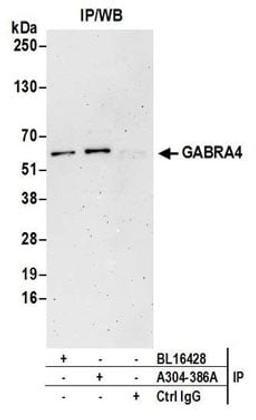 Detection of human GABRA4 by western blot of immunoprecipitates.