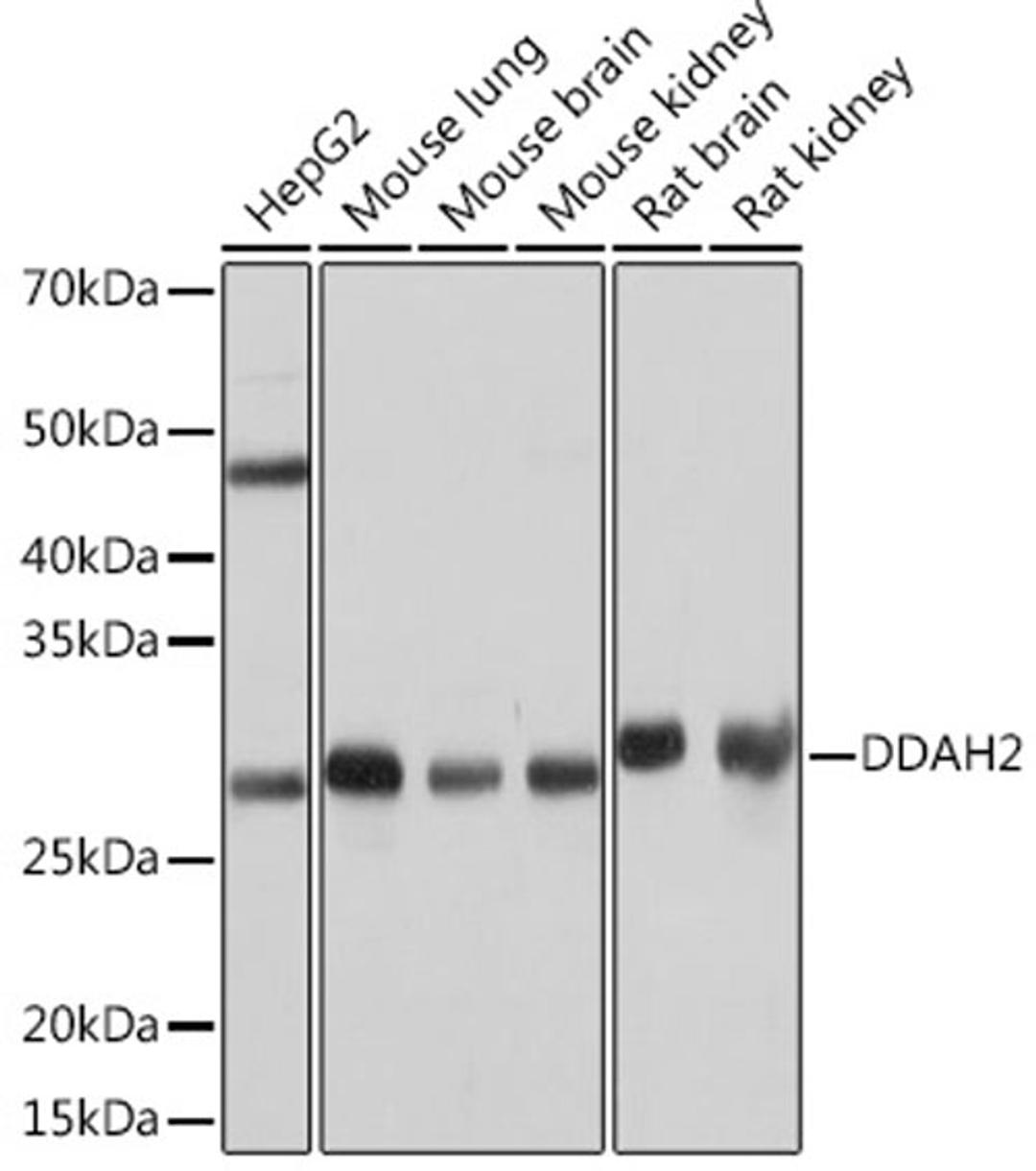 Western blot - DDAH2 Rabbit mAb (A4159)