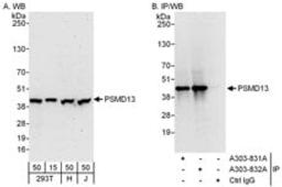 Detection of human PSMD13 by western blot and immunoprecipitation.