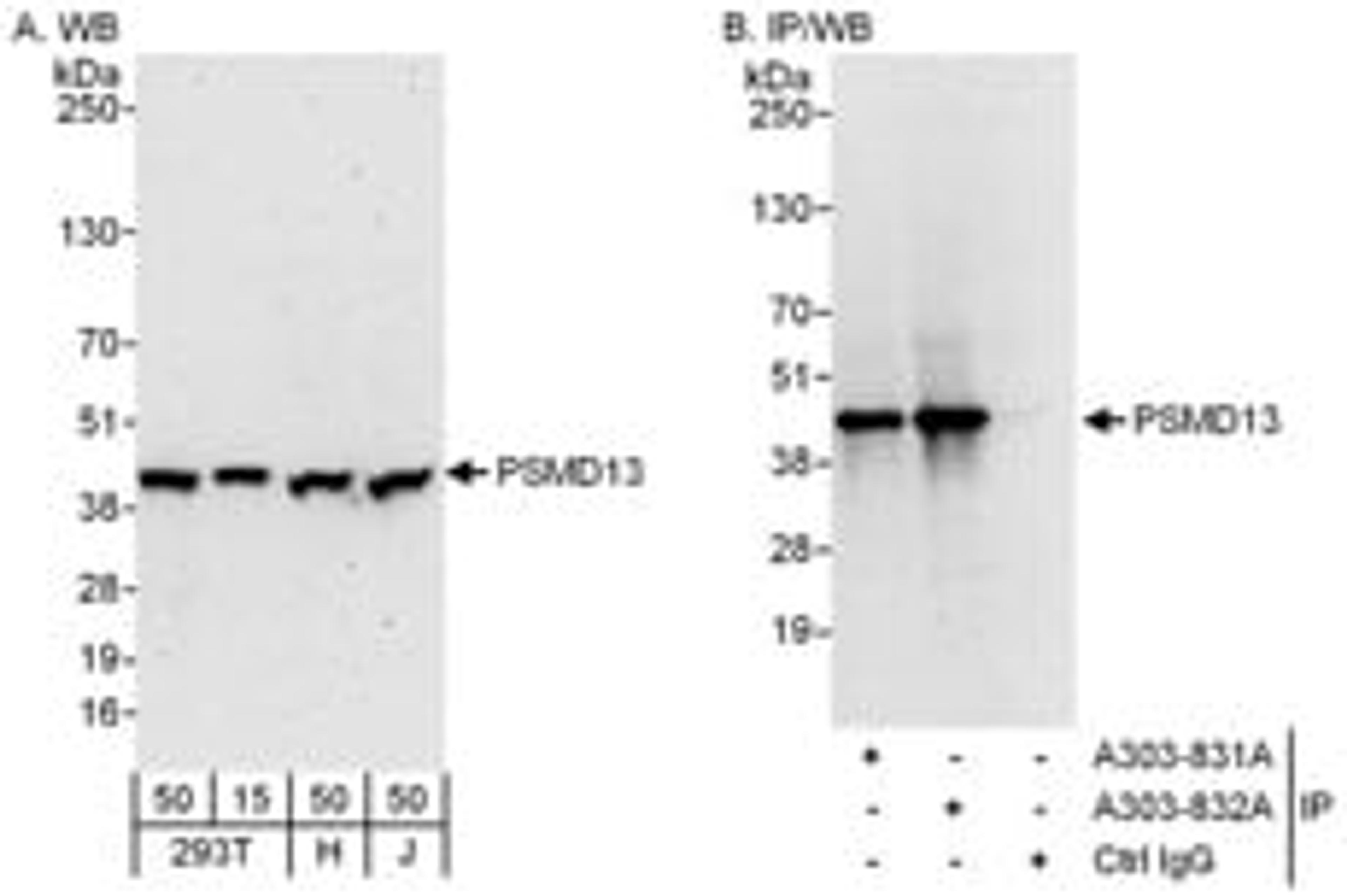 Detection of human PSMD13 by western blot and immunoprecipitation.