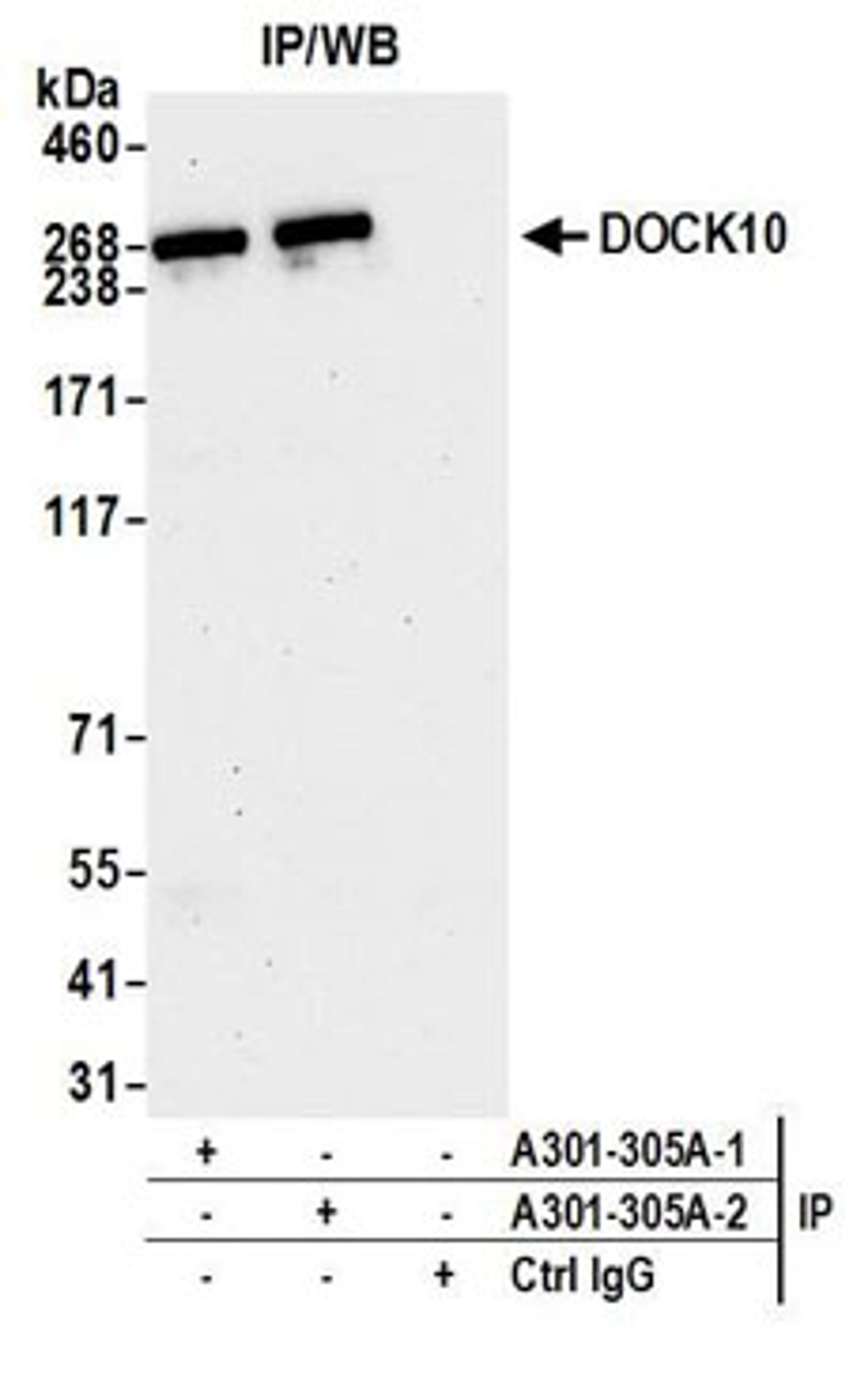 Detection of human DOCK10 by western blot of immunoprecipitates.