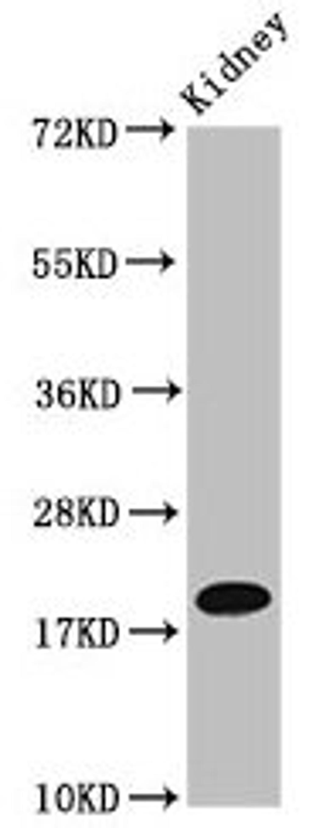 Western Blot. Positive WB detected in: Mouse kidney tissue. All lanes: NAA38 antibody at 4µg/ml. Secondary. Goat polyclonal to rabbit IgG at 1/50000 dilution. Predicted band size: 14, 19 kDa. Observed band size: 19 kDa