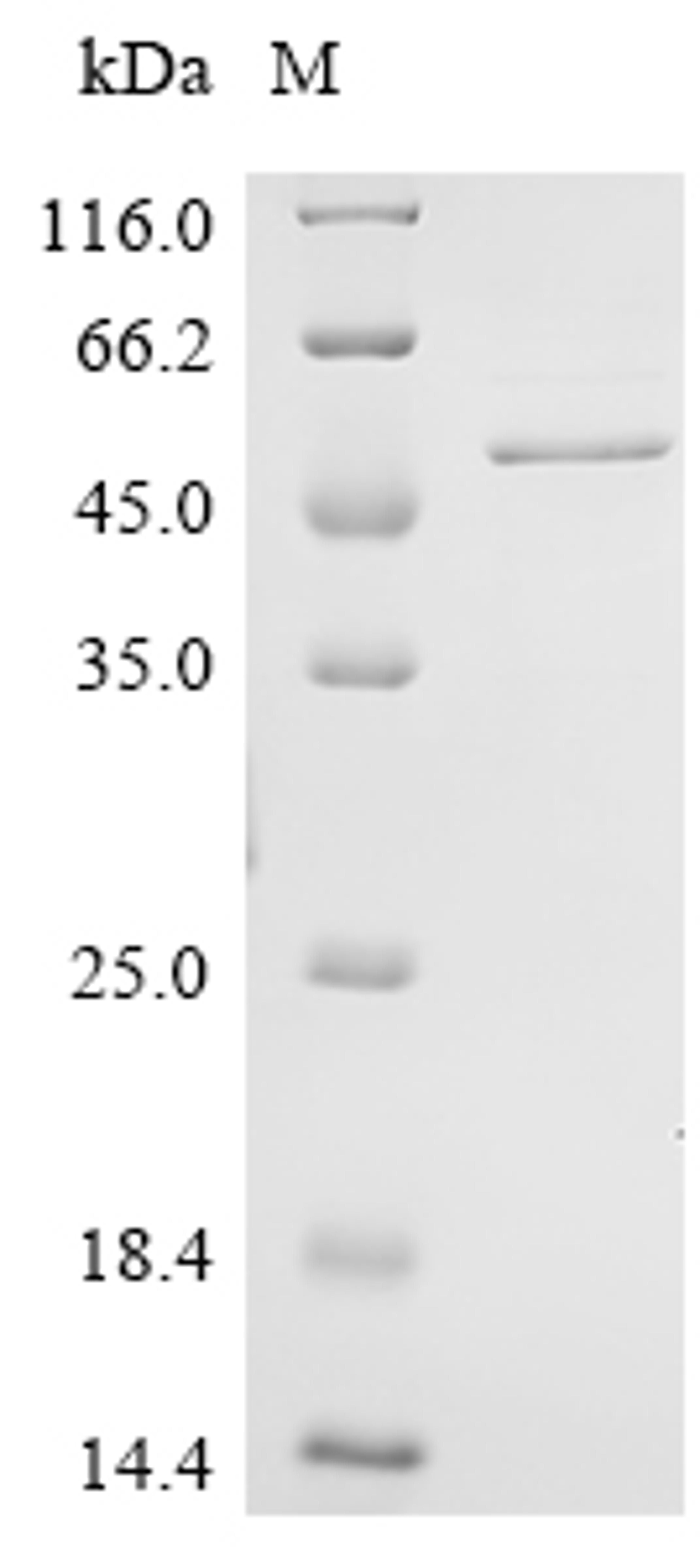 (Tris-Glycine gel) Discontinuous SDS-PAGE (reduced) with 5% enrichment gel and 15% separation gel.