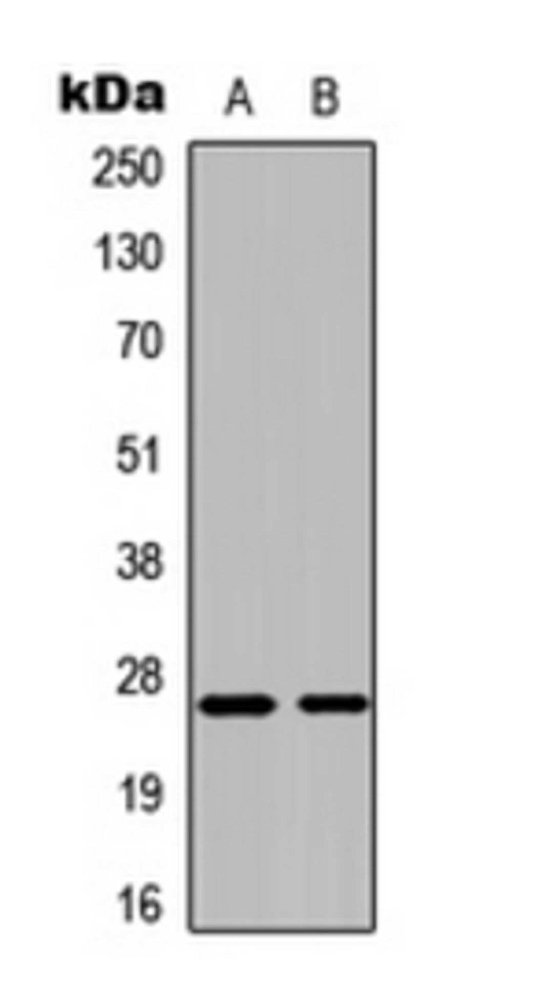 Western blot analysis of HEK293T (Lane 1), K562 (Lane 2) whole cell lysates using CMPK1 antibody