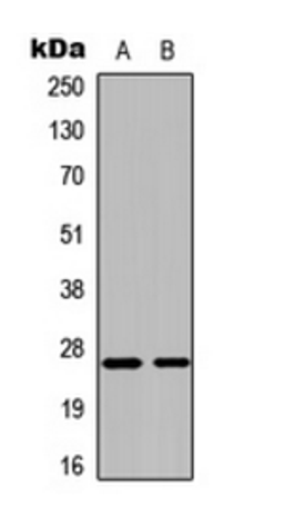 Western blot analysis of HEK293T (Lane 1), K562 (Lane 2) whole cell lysates using CMPK1 antibody