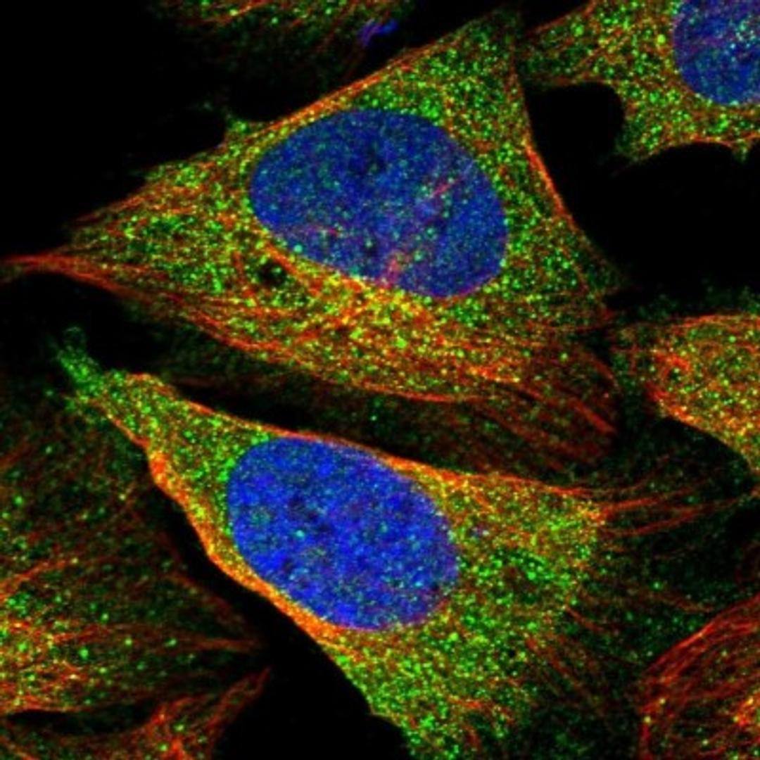 Immunocytochemistry/Immunofluorescence: ZNF181 Antibody [NBP1-92618] - Staining of human cell line U-2 OS shows positivity in cytoplasm.