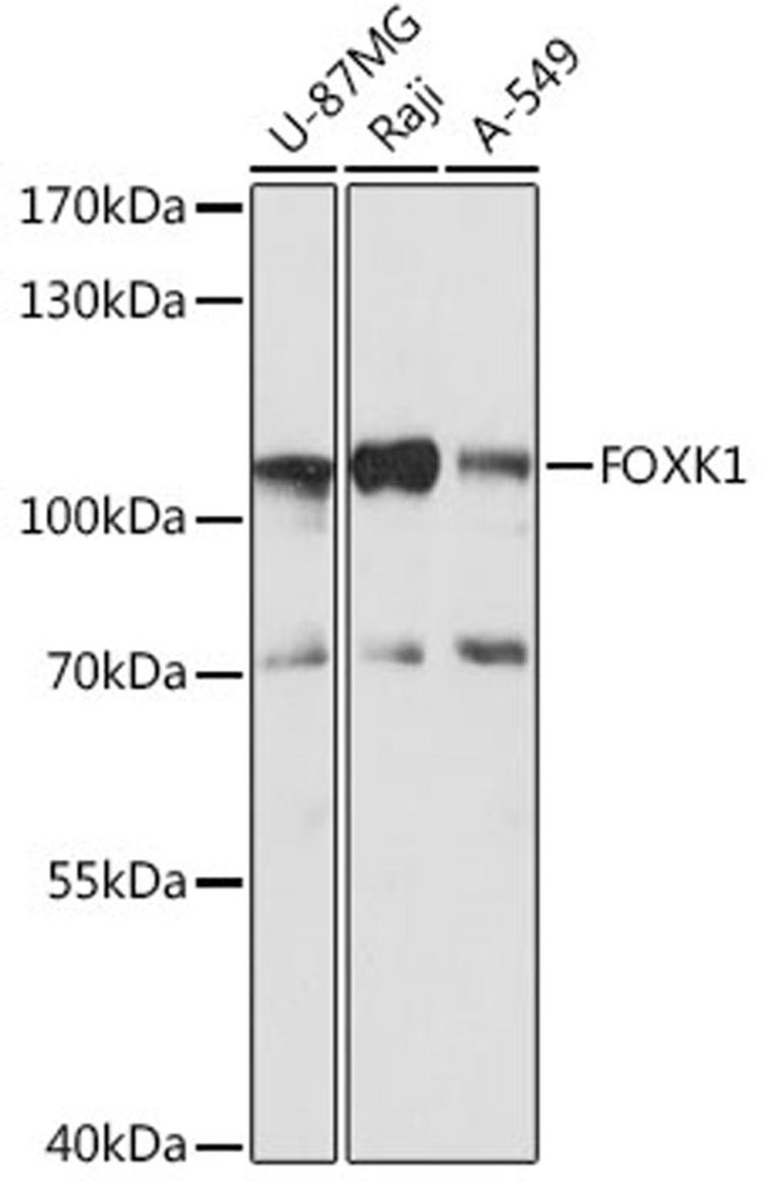 Western blot - FOXK1 antibody (A15220)