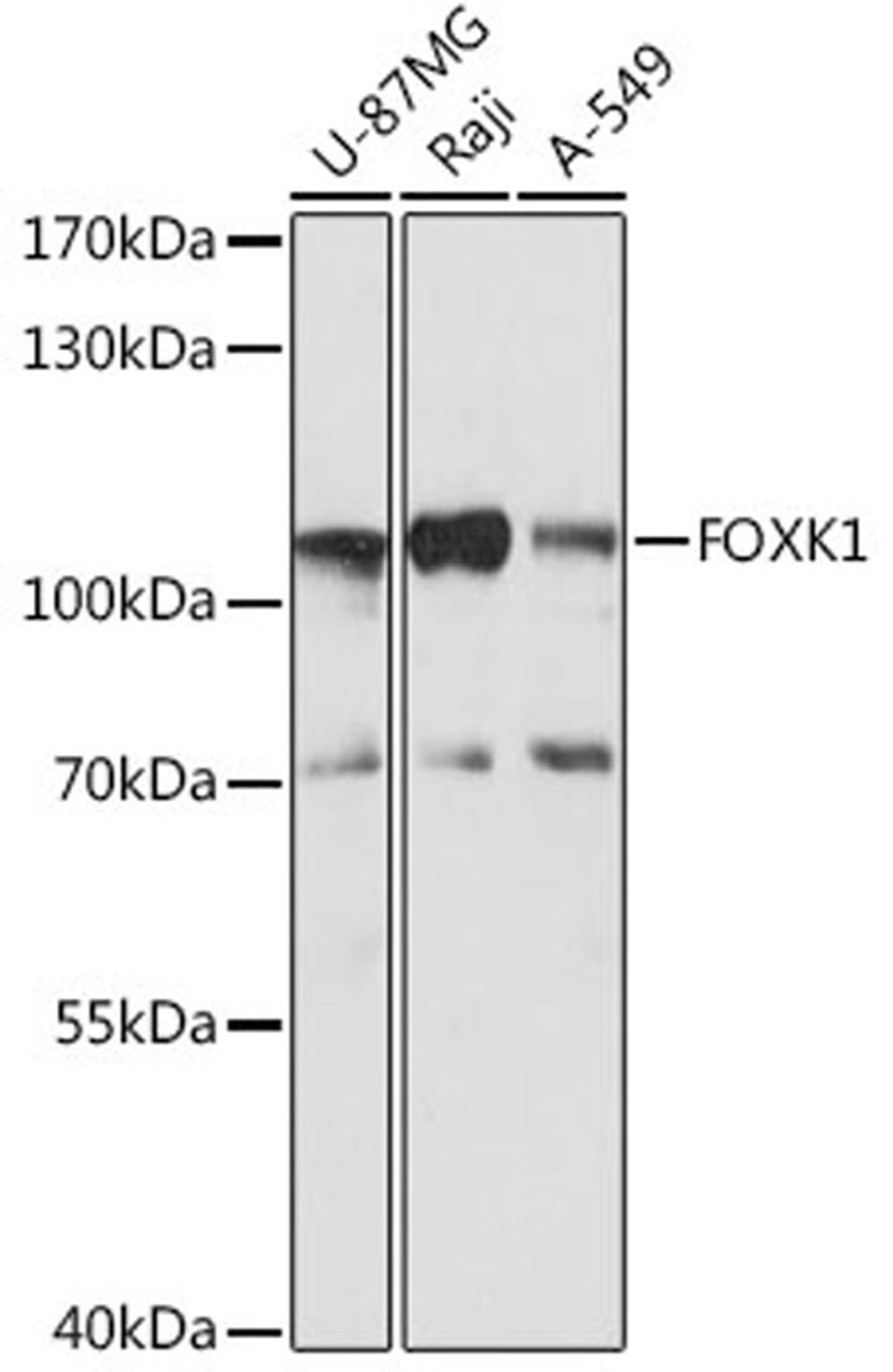 Western blot - FOXK1 antibody (A15220)