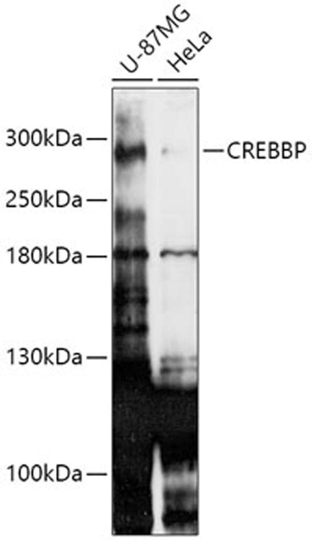 Western blot - CREBBP antibody (A1334)