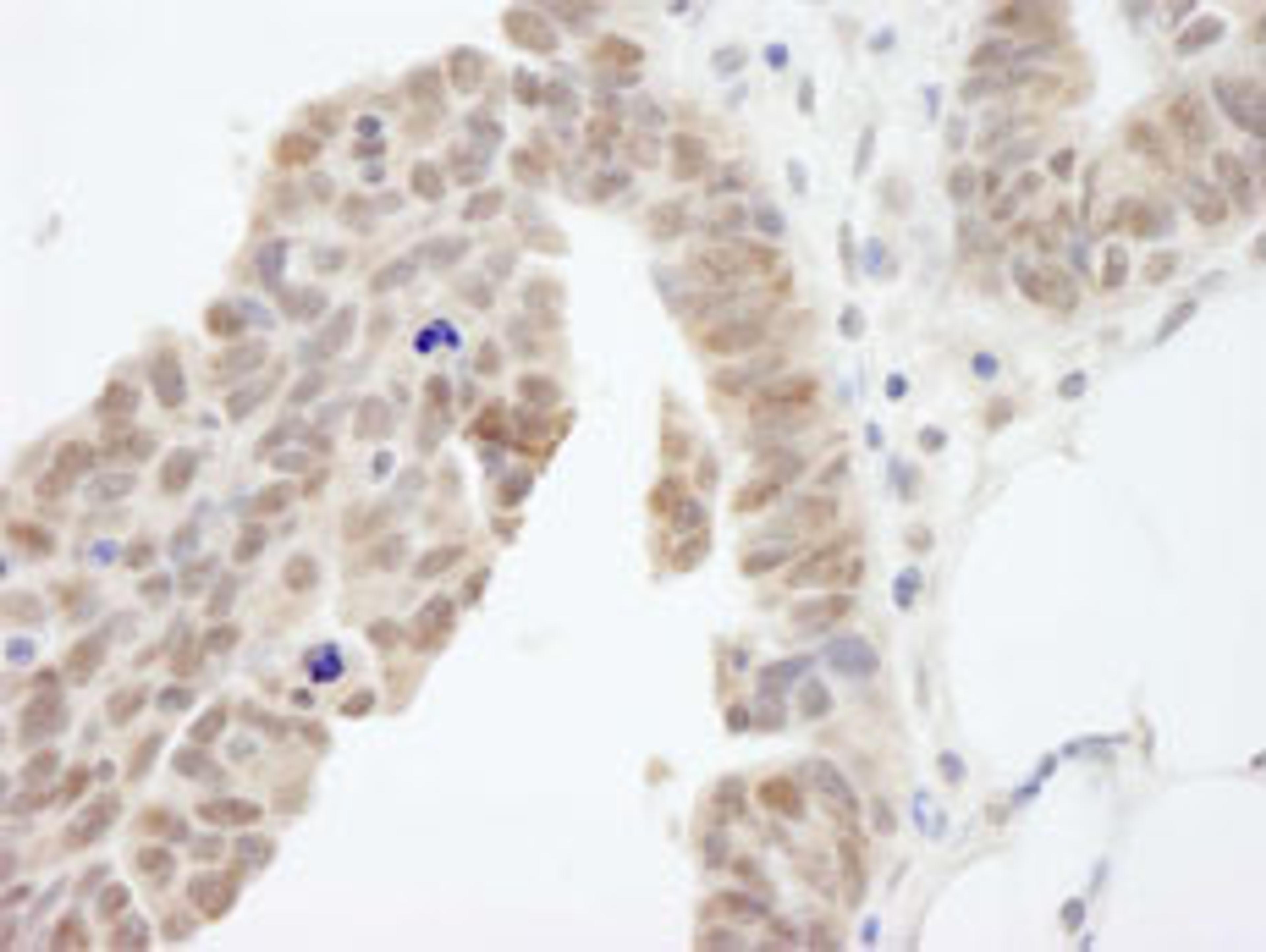 Detection of human ABI1 by immunohistochemistry.