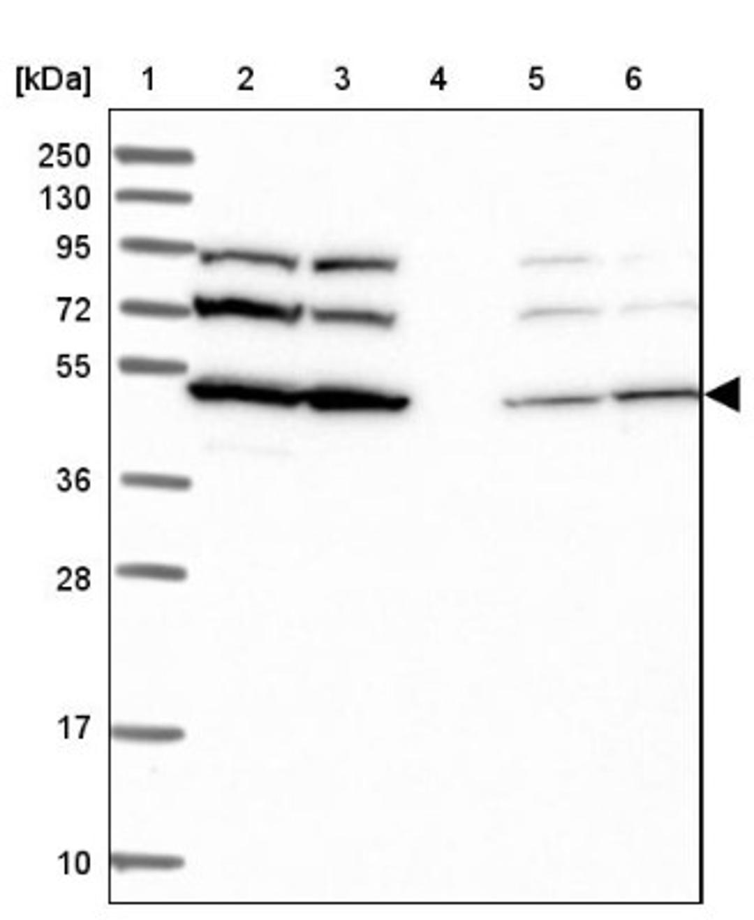 Western Blot: SLC46A3 Antibody [NBP1-85054] - Lane 1: Marker [kDa] 250, 130, 95, 72, 55, 36, 28, 17, 10<br/>Lane 2: Human cell line RT-4<br/>Lane 3: Human cell line U-251MG sp<br/>Lane 4: Human plasma (IgG/HSA depleted)<br/>Lane 5: Human liver tissue<br/>Lane 6: Human tonsil tissue