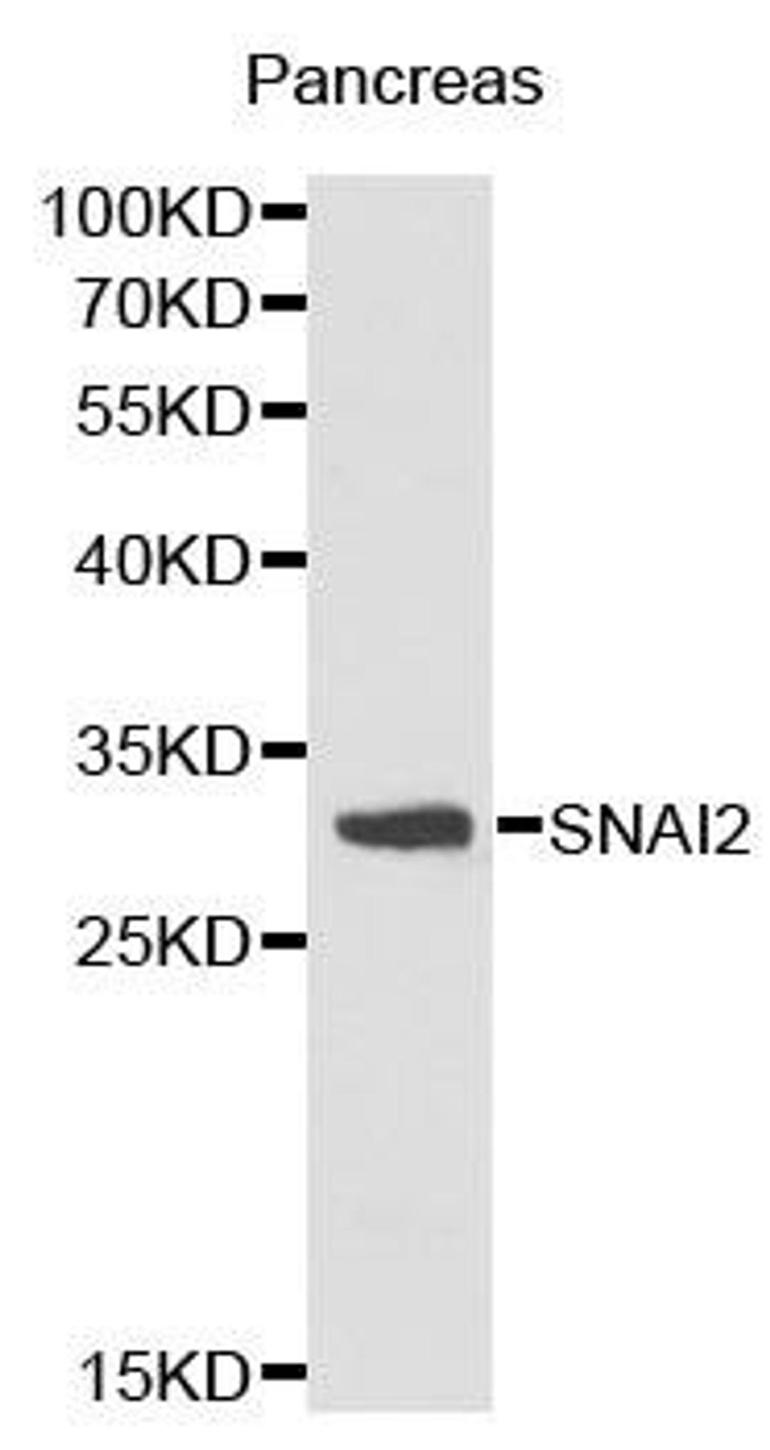 Western blot analysis of pancreas cell lysate using SNAI2 antibody