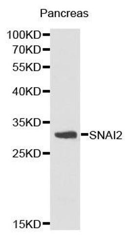 Western blot analysis of pancreas cell lysate using SNAI2 antibody