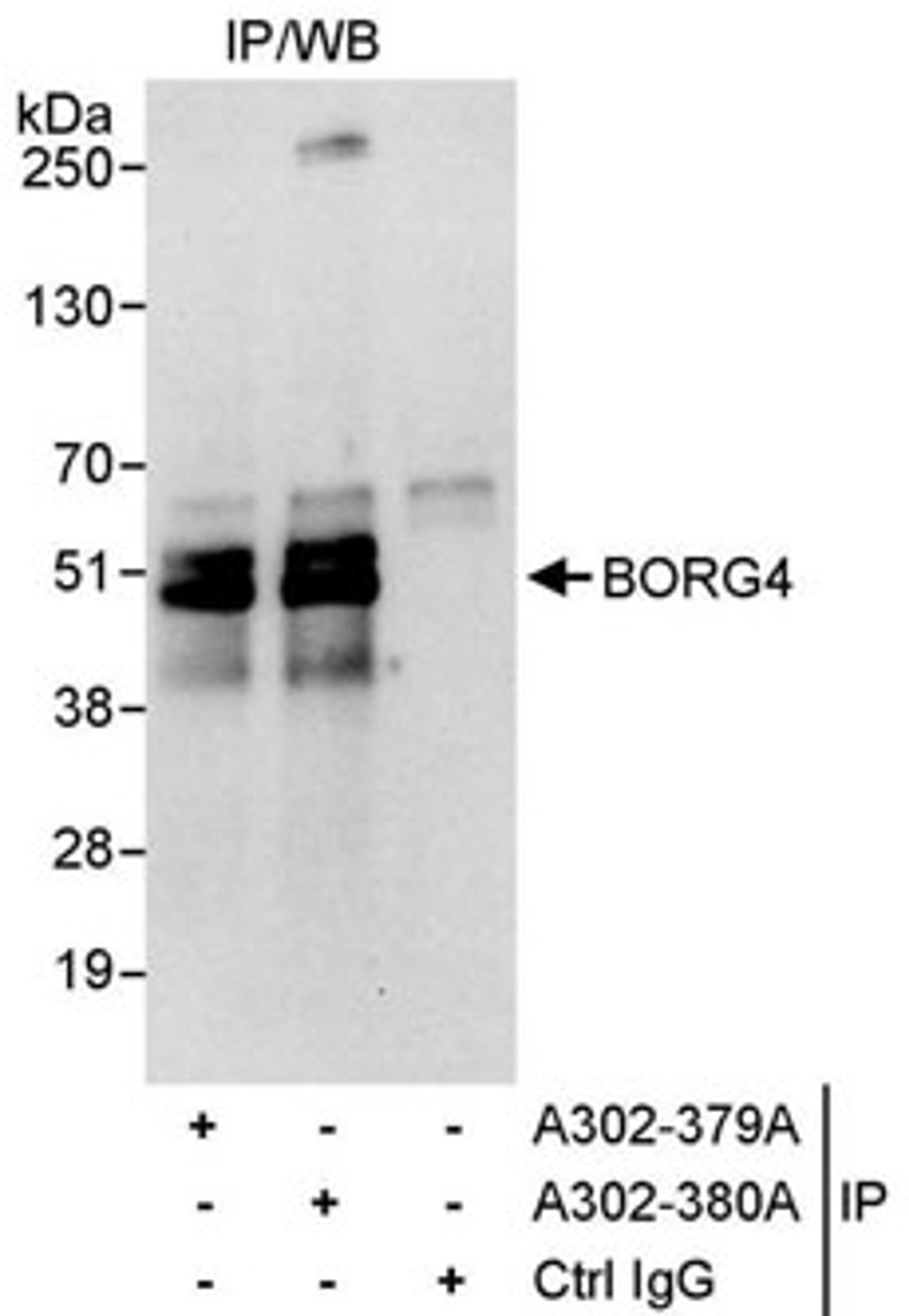 Detection of human BORG4 by western blot of immunoprecipitates.