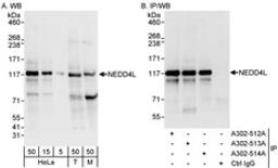 Detection of human and mouse NEDD4L by western blot (h&m) and immunoprecipitation (h).