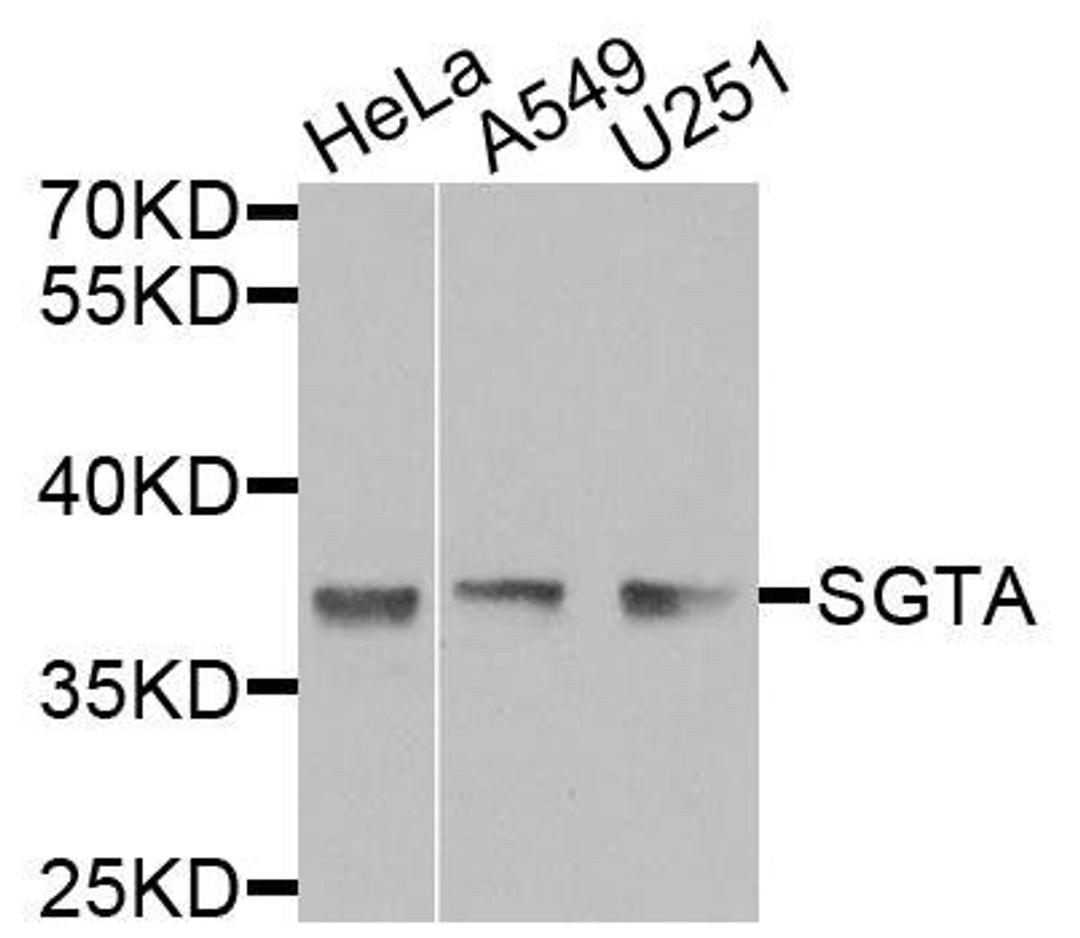 Western blot analysis of extracts of various cells using SGTA antibody