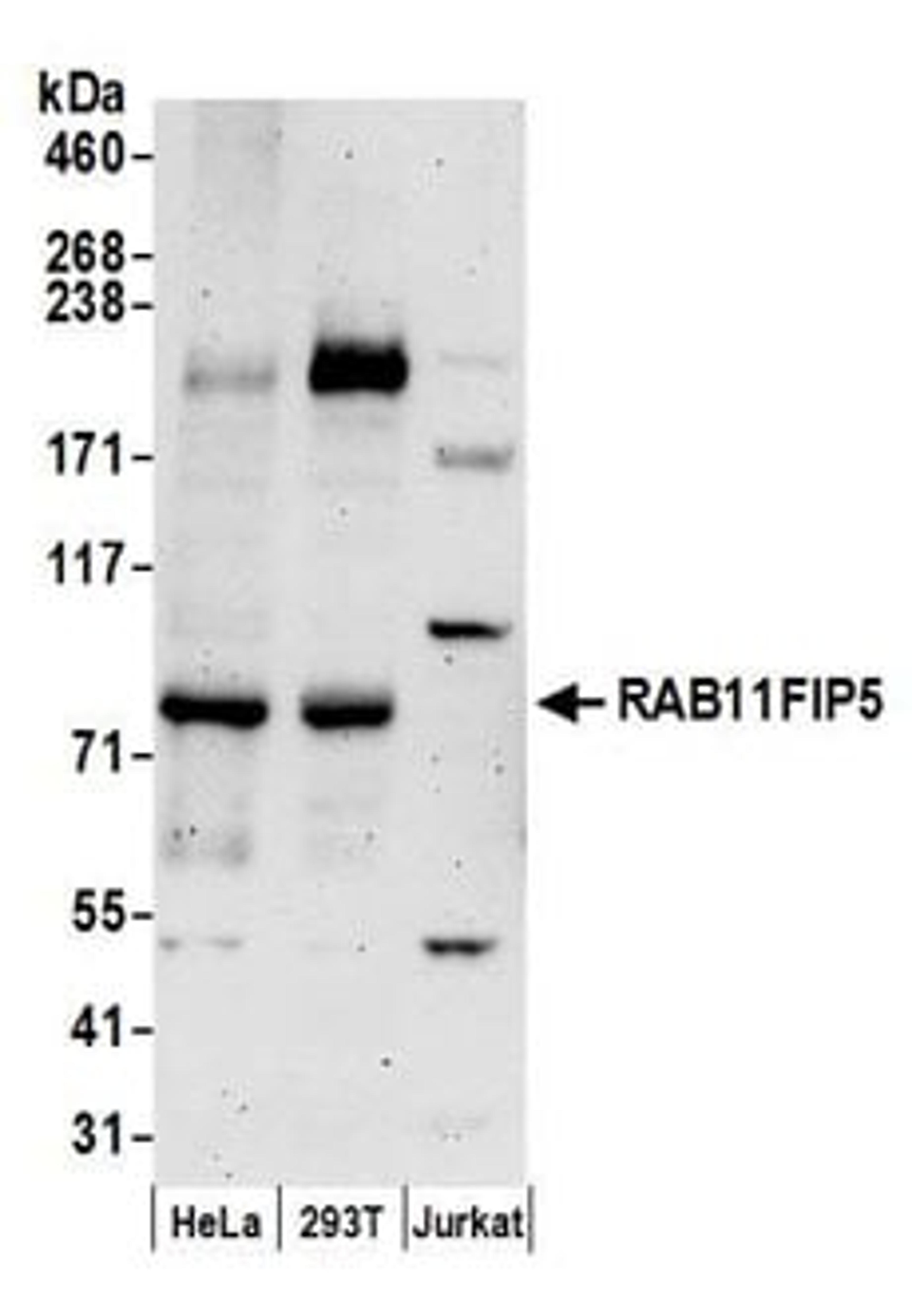 Detection of human RAB11FIP5 by western blot.