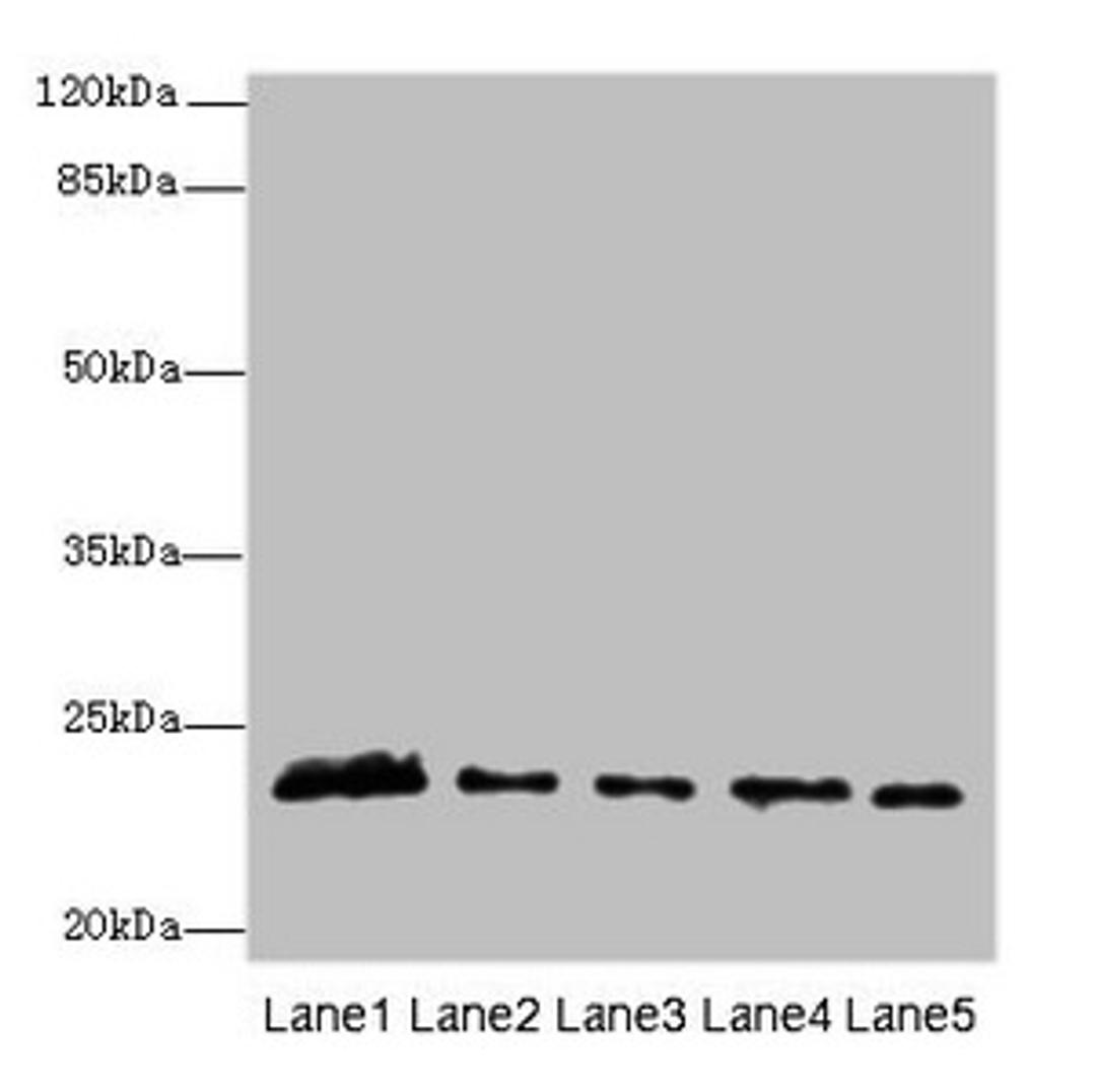 Western blot. All lanes: MMD2 antibody at 3µg/ml. Lane 1: Mouse brain tissue. Lane 2: Mouse kidney tissue. Lane 3: U251 whole cell lysate. Lane 4: 293T whole cell lysate. Lane 5: Mouse liver tissue. Secondary. Goat polyclonal to rabbit IgG at 1/10000 dilution. Predicted band size: 32, 29, 23 kDa. Observed band size: 23 kDa
