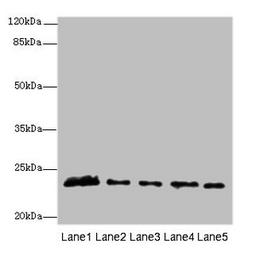 Western blot. All lanes: MMD2 antibody at 3µg/ml. Lane 1: Mouse brain tissue. Lane 2: Mouse kidney tissue. Lane 3: U251 whole cell lysate. Lane 4: 293T whole cell lysate. Lane 5: Mouse liver tissue. Secondary. Goat polyclonal to rabbit IgG at 1/10000 dilution. Predicted band size: 32, 29, 23 kDa. Observed band size: 23 kDa