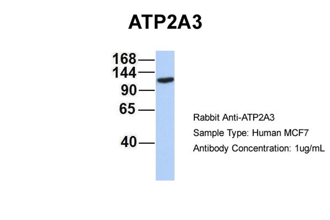 Antibody used in WB on Human MCF7 at 1 ug/ml.