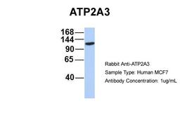 Antibody used in WB on Human MCF7 at 1 ug/ml.