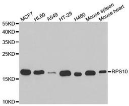 Western blot analysis of extracts of various cell lines using RPS10 antibody