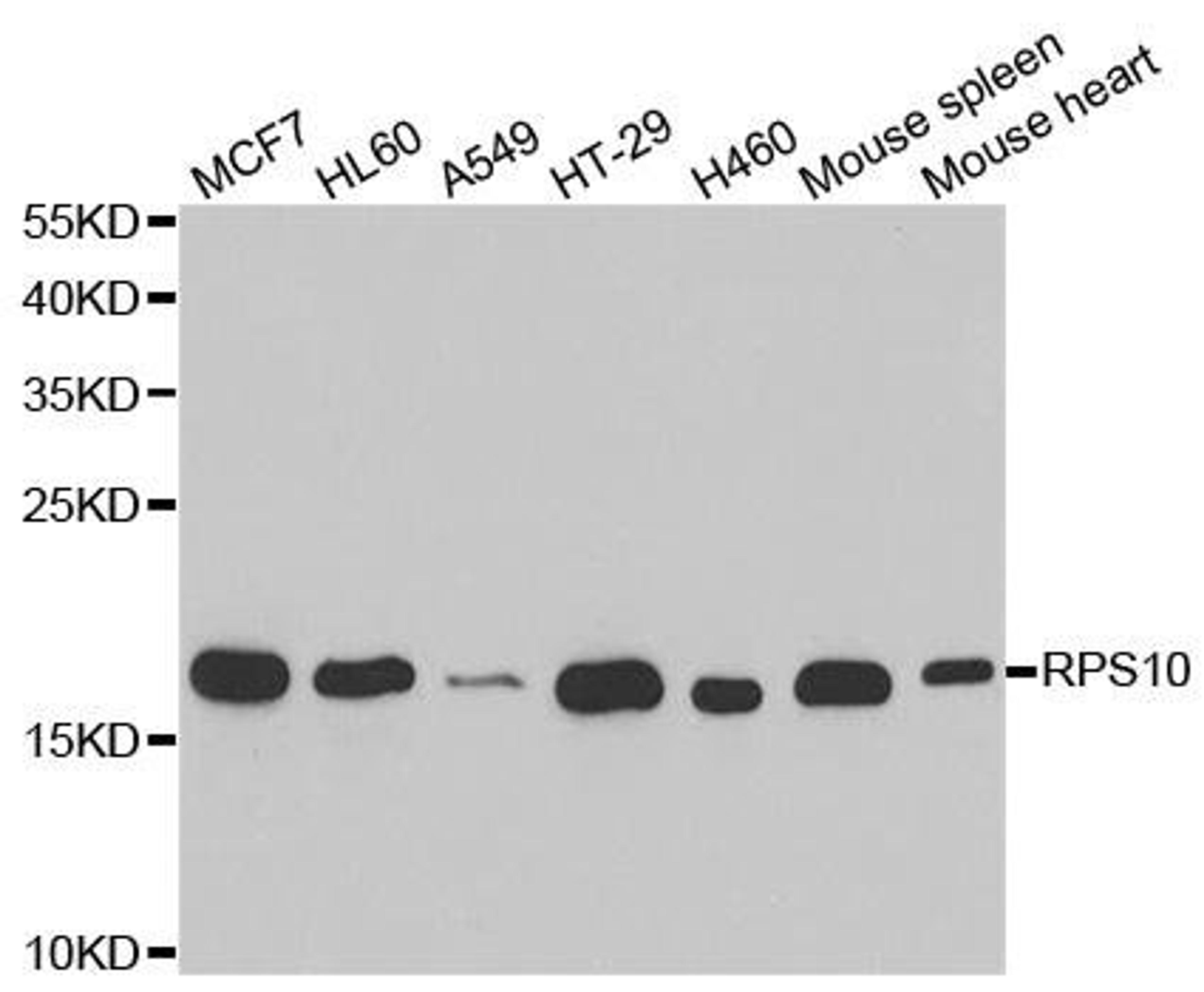 Western blot analysis of extracts of various cell lines using RPS10 antibody